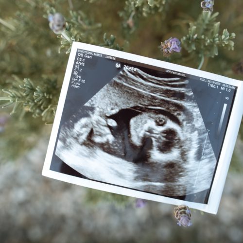 The cost of egg donation. Photo of a sonograph with greenery in the background.